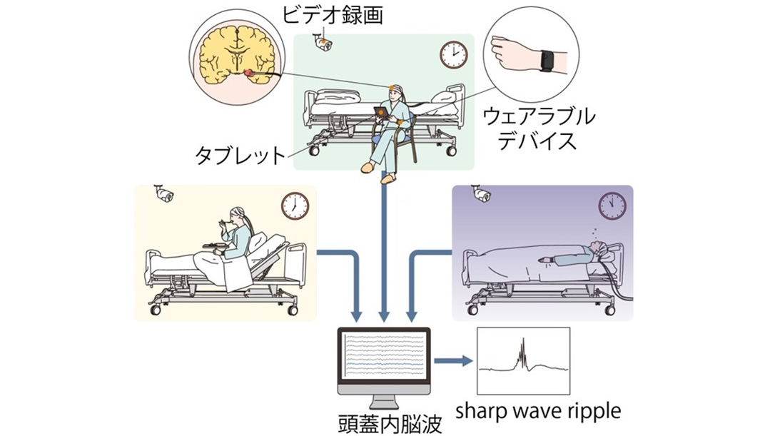 iwata_top iwata_top